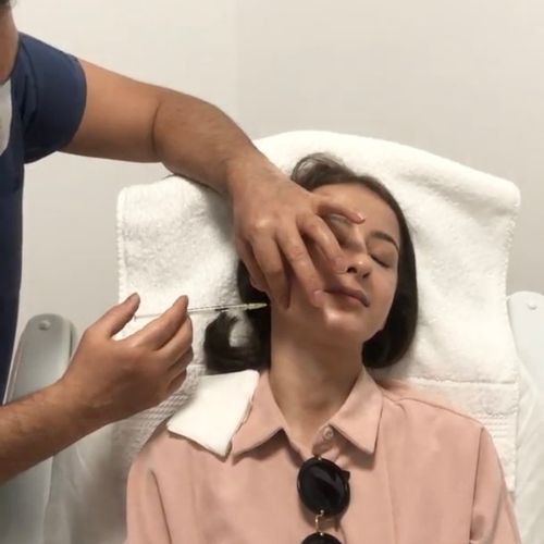 Botox Injections Into the Jawline