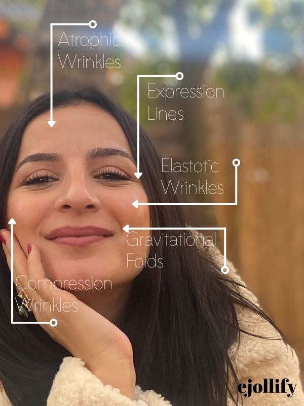 Types of Wrinkles and Where They Appear on The Face - Image by Ejollify