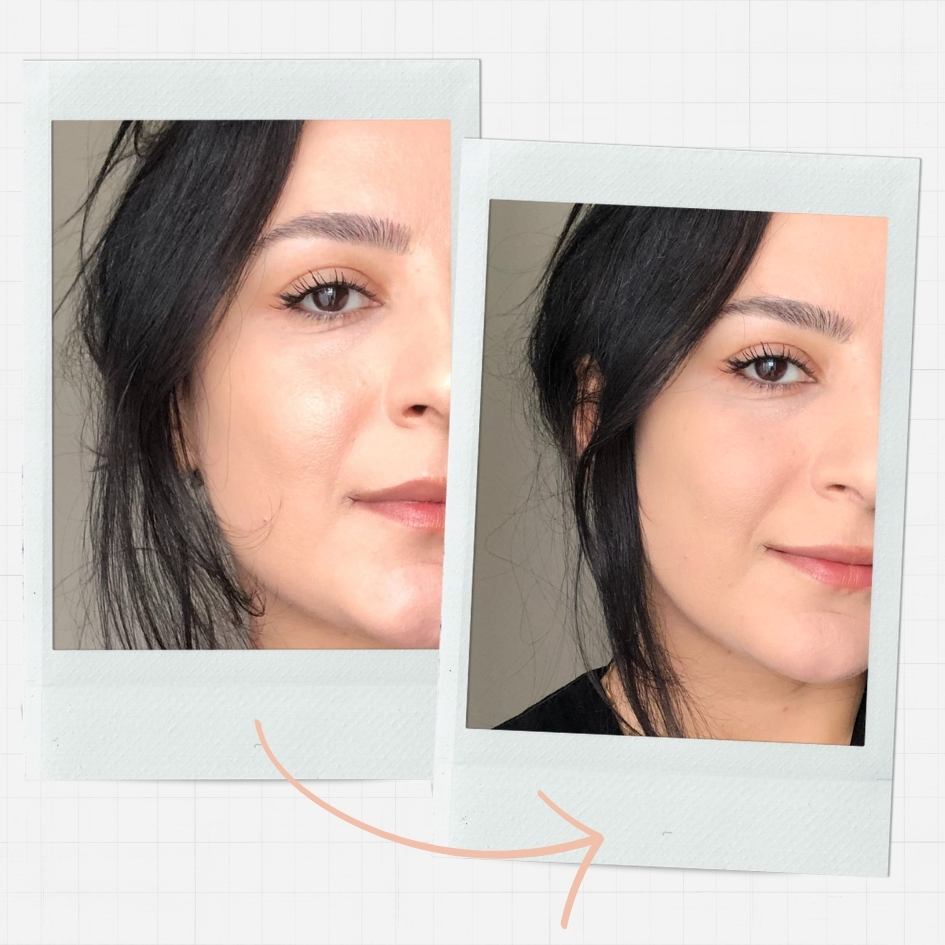 Setting Powder Application - Before After Setting Powder Application - Before After