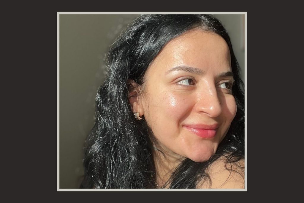 Clinique Moisture Surge Active Glow Serum Before After