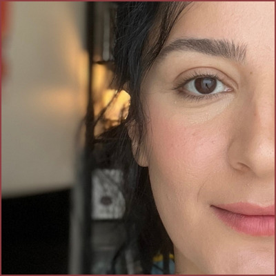 Close-up of me wearing Benetint on cheeks